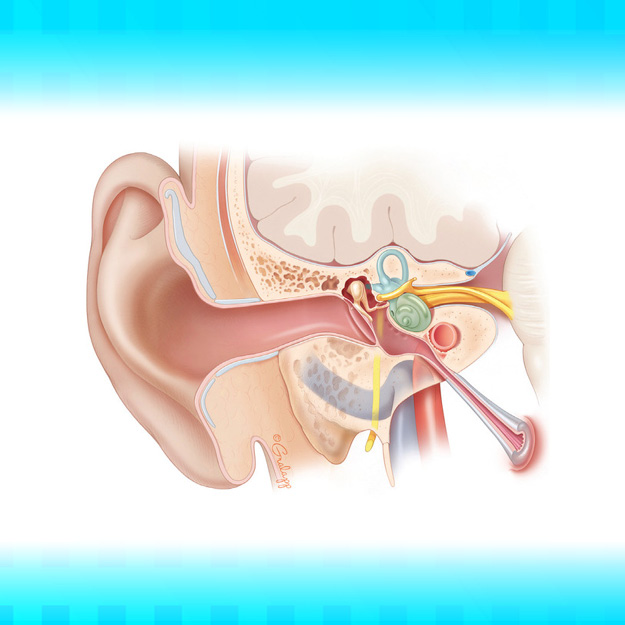 Stanford Otology Update 2026 Banner